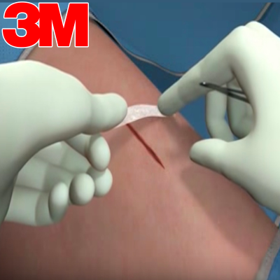 Steri-Strip 3M Cura del piercing