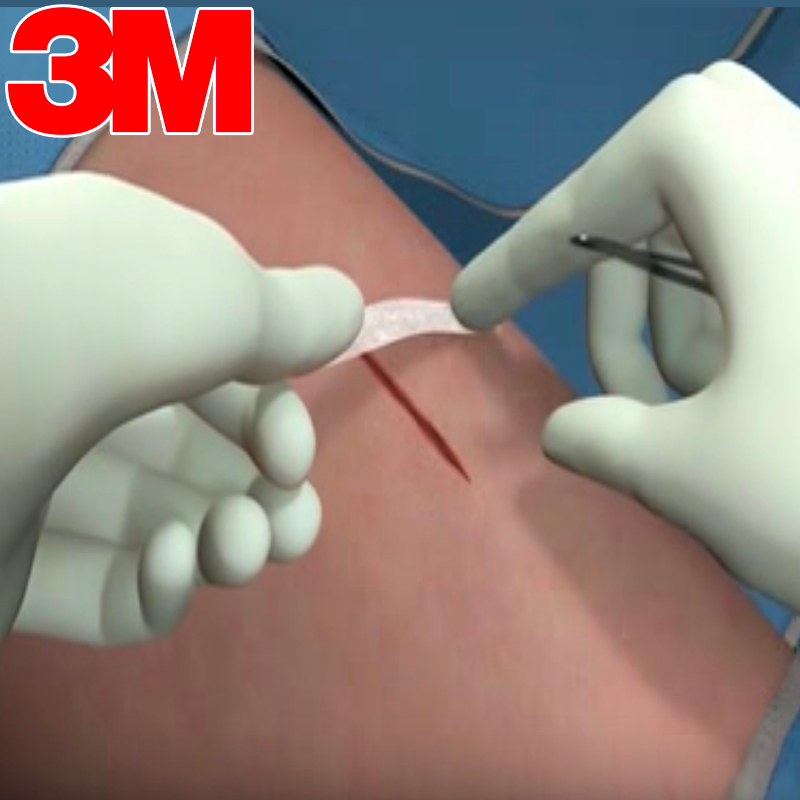 Steri-Strip 3M Cura del piercing